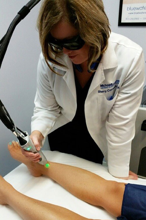 Laser Hair Removal Treatment
